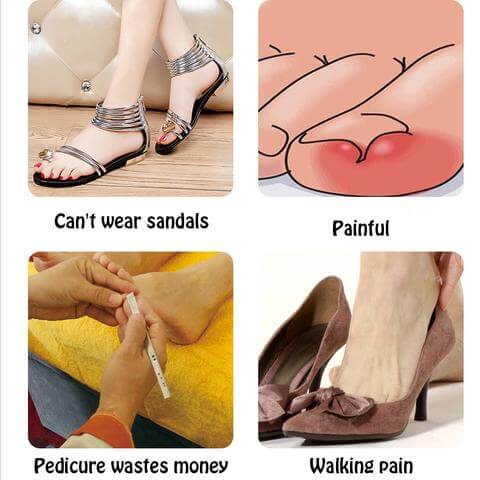 NAILPATCH 4