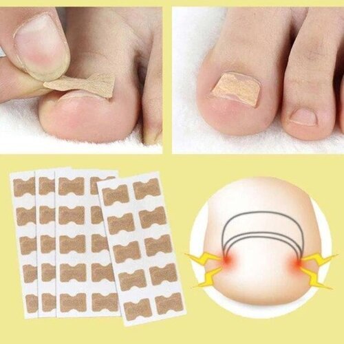 NAILPATCH